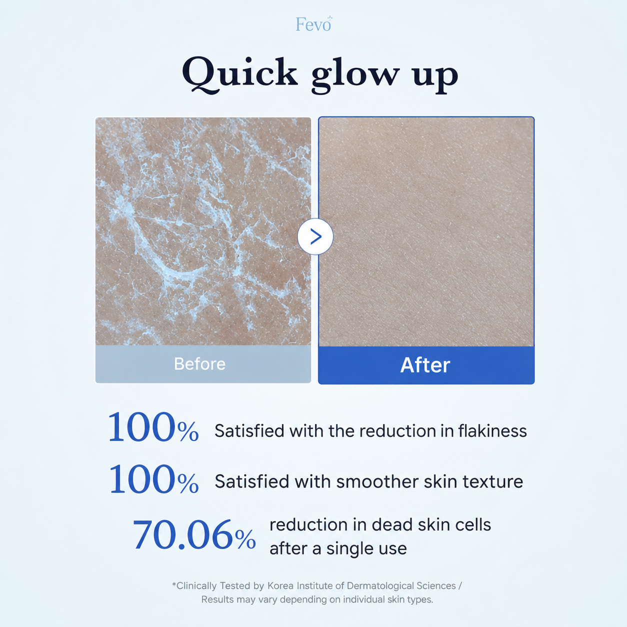 Zero Pore Peel Pad