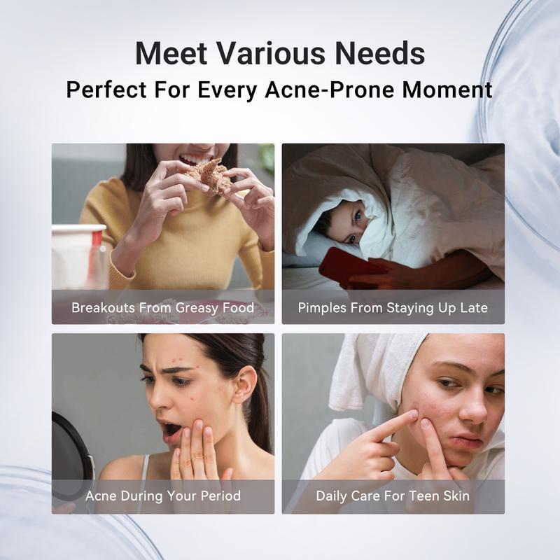 Acne Spot Drying Lotion