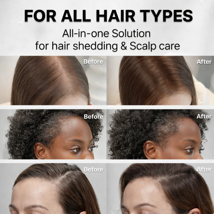 Reviving Hair Scalp Growth Serum