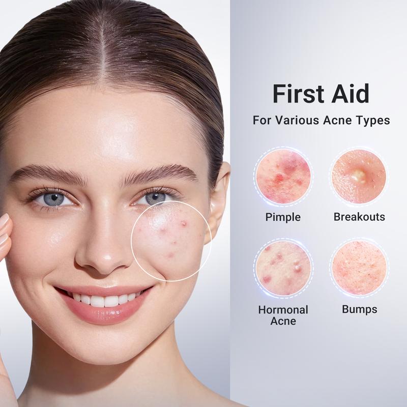 Acne Spot Drying Lotion